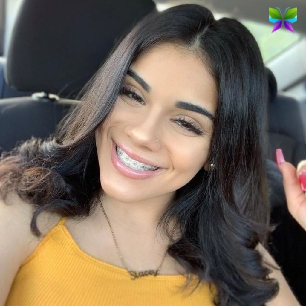 Braces Captions For Instagram